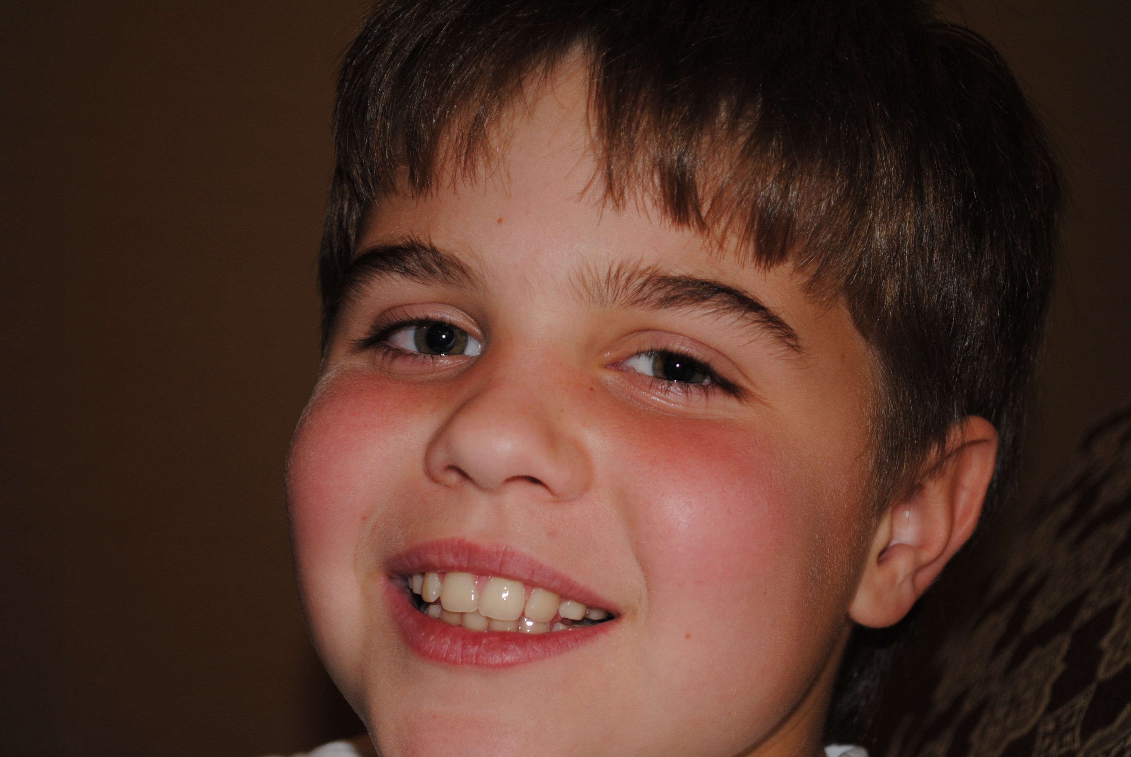 Was Diagnosed With Nephrotic Syndrome And Since That Time We Have Been Riding An Emotional Roller Coaster Christian Started Waking Up With Puffy Eyes Was Diagnosed With Nephrotic Syndrome And Since That Time We Have Been Riding An Emotional Roller Coaster Christian Started Waking Up With Puffy Eyes