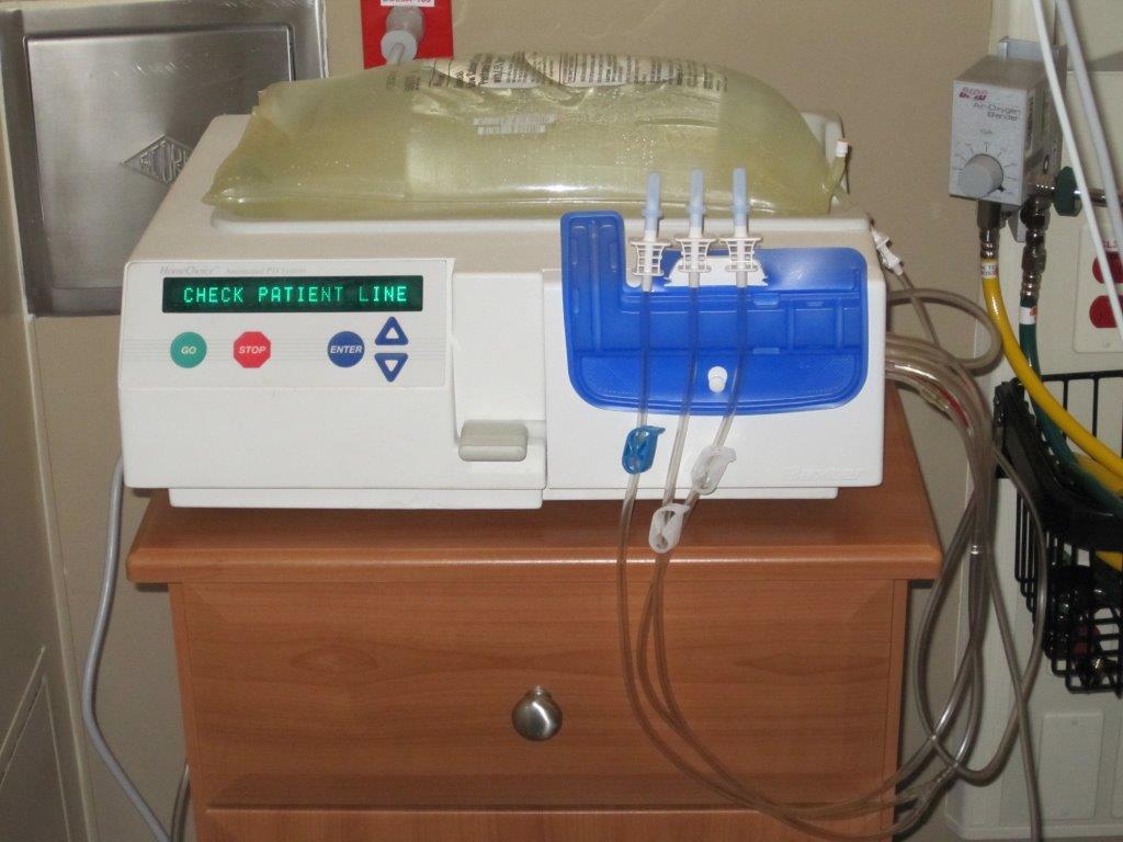 How Is Peritoneal Dialysis Done