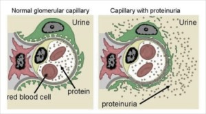 NS capillary