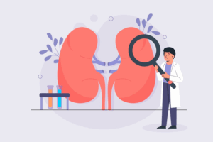 Difference Between IgA Nephropathy and IgM Nephropathy